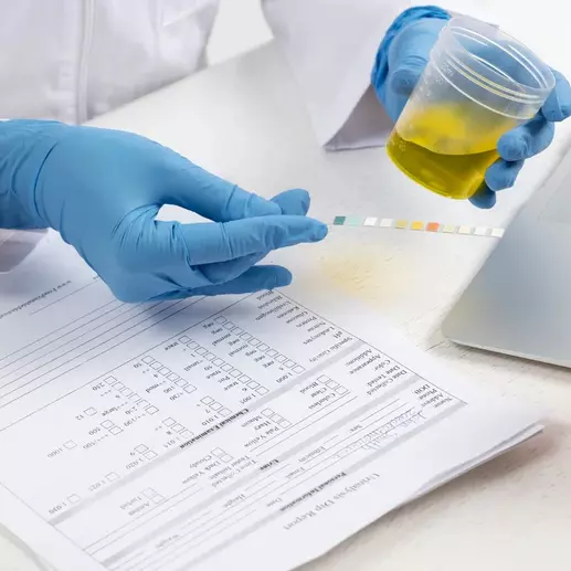 врач проводит общеклинические анализы мочи